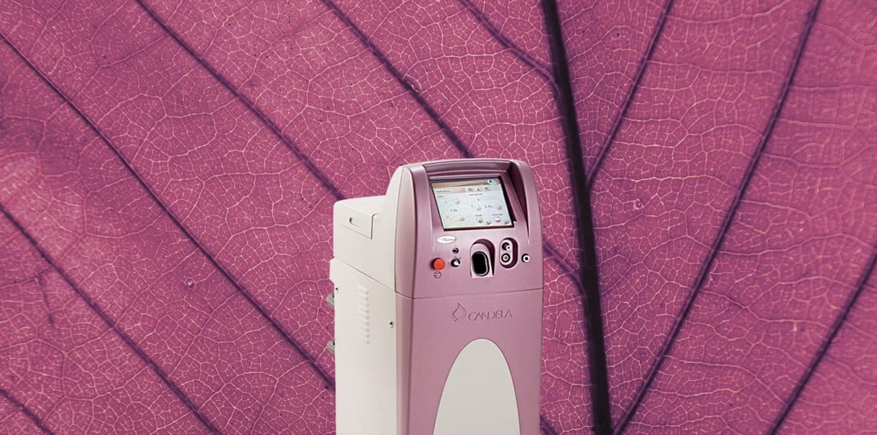 V-Beam Laser